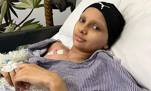 Phát hiện khối u não nhờ triệu chứng lạ ở mắt